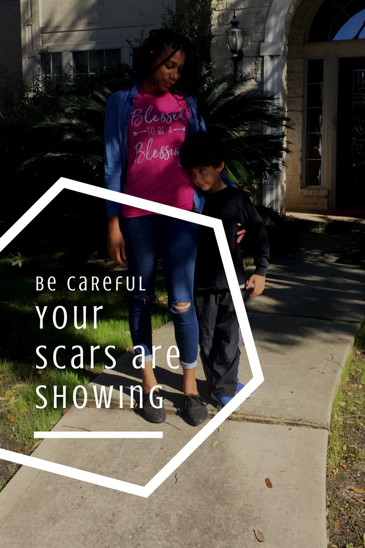 Some people need to hear about my scars. The scars are not separate from my #blessed #thelife. The scars are absolutely essential to my survival and the survival of those around me.